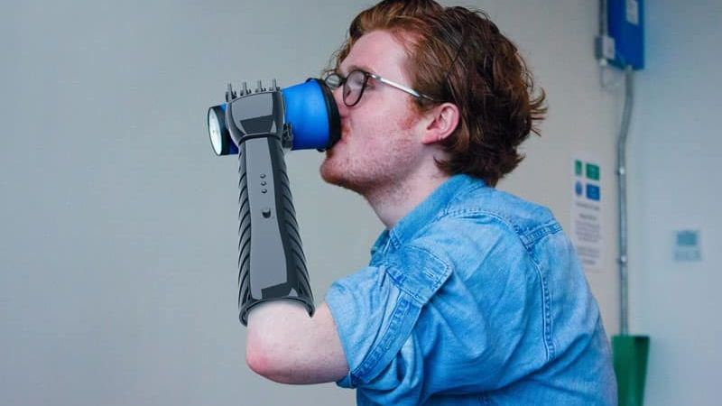 3D printed prosthetic