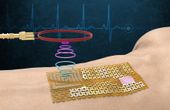 Engineers fabricate a chip-free, wireless electronic "skin"