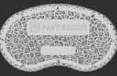 Designing a 3D Printed, Elastomeric Lattice Wrist Rest
