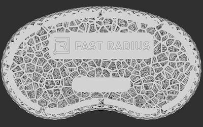 Designing a 3D Printed, Elastomeric Lattice Wrist Rest