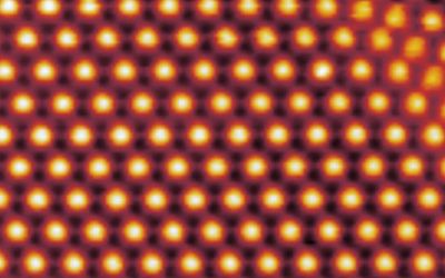 Unusual Superconductivity Observed in Twisted Trilayer Graphene