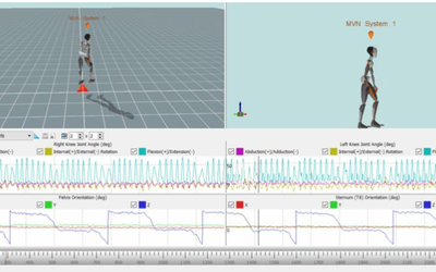 Advancing patient care with real-time balance biofeedback and Xsens analysis