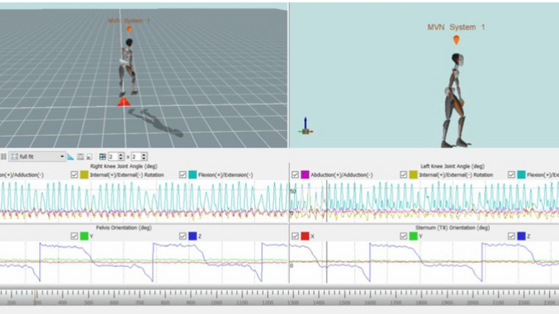 Advancing patient care with real-time balance biofeedback and Xsens analysis