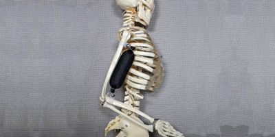 Skeleton with an artificial bicep. Credit: Aslan Miriyev - Columbia Engineering