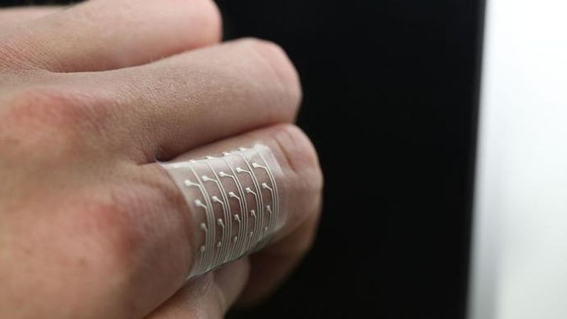 An array of silver-TPU ink sensors printed on a flexible TPU base. (Image courtesy of the Wyss Institute for Biologically Inspired Engineering)