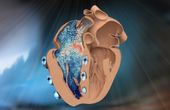 MIT engineers design a robotic replica of the heart's right chamber