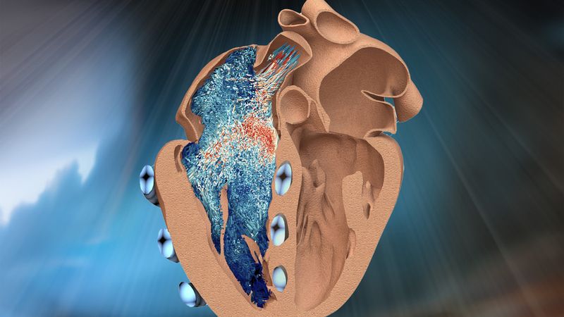 A new bio-robotic model developed by MIT engineers simulates the function of the heart’s lesser-known right ventricle (illustrated here in cross-section, as seen from a front view, on the left). Soft, balloon-like “muscles” (in blue) wrap around and contract the ventricle, mimicking its real pumping action. The model could help to test new implants and devices to treat a range of cardiac disorders. Credit: Courtesy of the researchers