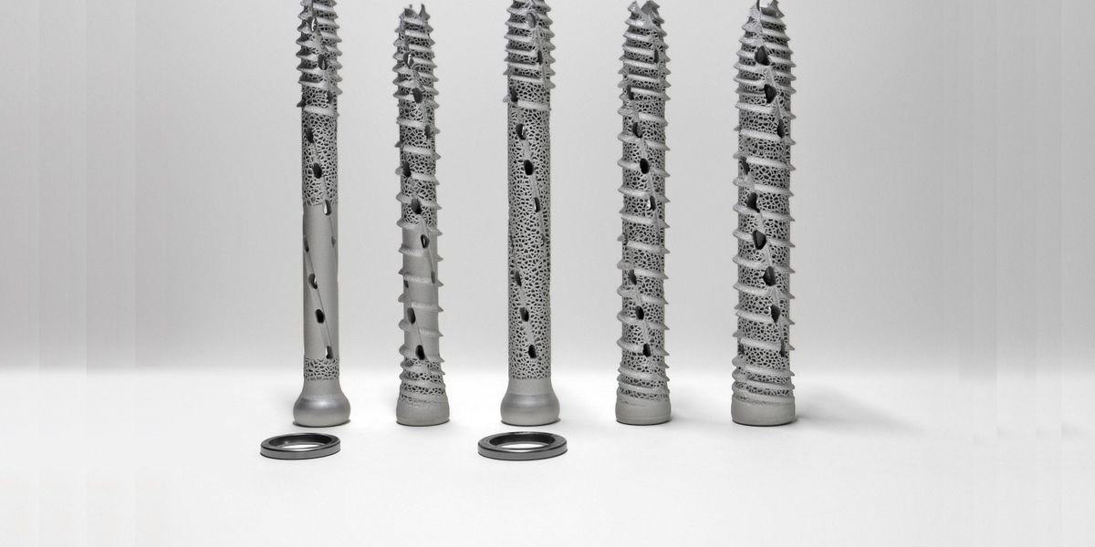 SI-BONE Achieves Design-at-Scale of Additive Implants with Batch Processing