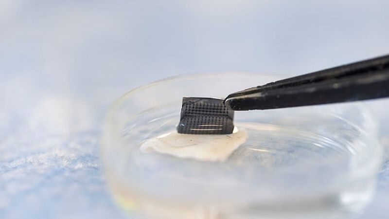 The newly designed ExoPatch being removed from a sample of mouse skin successfully distinguished melanoma from healthy skin in mice. A gel coating the microneedles picks up cancer indicators from the top-most layer of the skin. Dissolving the gel releases exosomes into a solution, which is then used on a two-lined test strip, similar to an at-home COVID-19 test. Credit: Jeremy Little, Michigan Engineering.