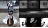 Robotic Scanner Automates Diagnostic Imaging in the Eye
