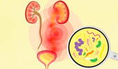 Algorithm reduces unnecessary use of antibiotics for UTIs