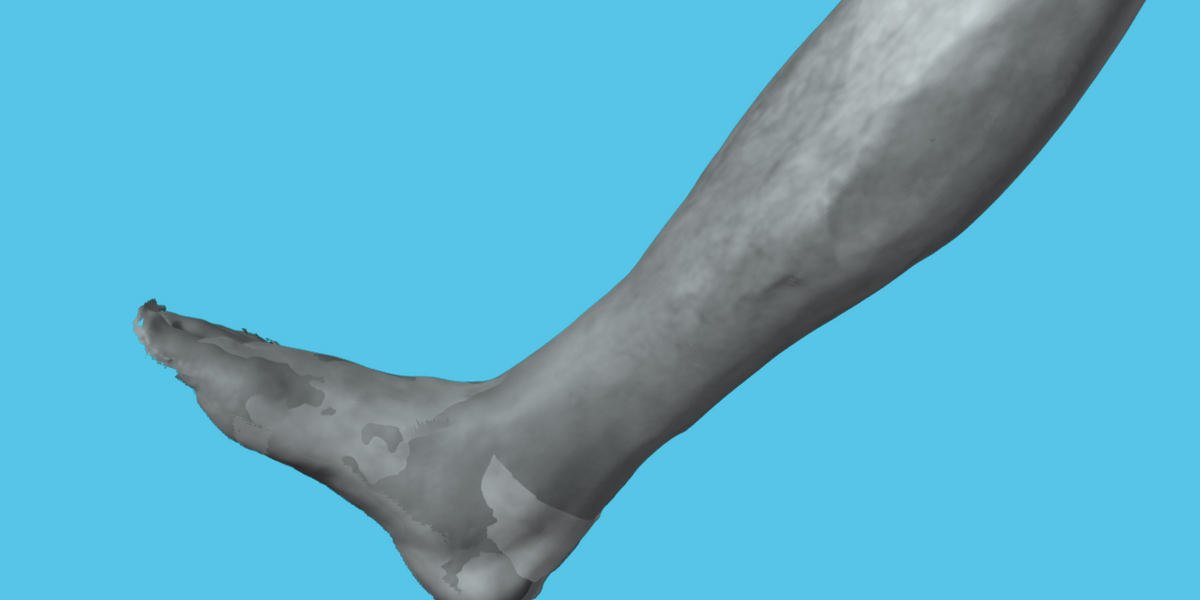 3D leg scan