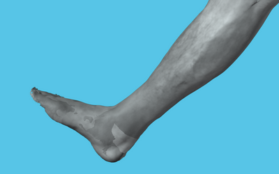 Scanning a human body part