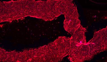 3D-printed blood vessels bring artificial organs closer to reality