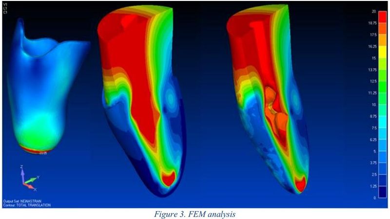 The Creaform Health Care Partner 3D Scanner Makes Life Easier For Doctors And Patients Alike!