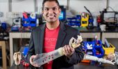 Prosthetic arms can provide controlled sensory feedback, study finds