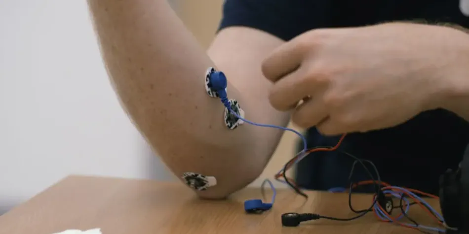 Designing a 3D-printed EMG bionic hand as a low-cost alternative to  prosthetic limbs