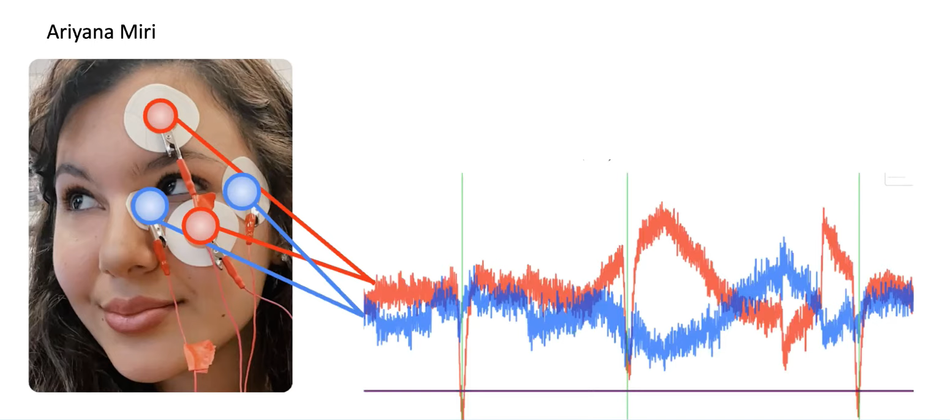 EOG-signals-detect-eye-blinking