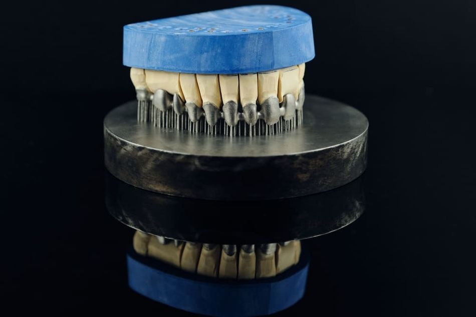 Tooth dental crowns created on a 3d SLS printer form metal. Gypsum model on a printed metal frame