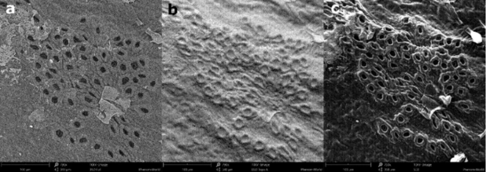 a) Full BSD, b) Topography BSD and c) SED image of a leaf; Source: azom