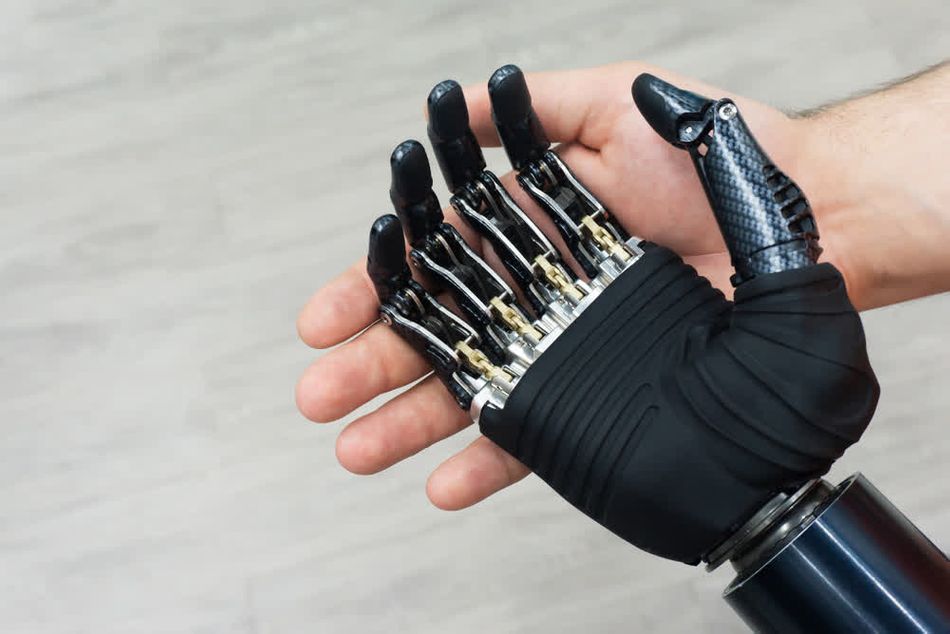 An artificial robotic limb