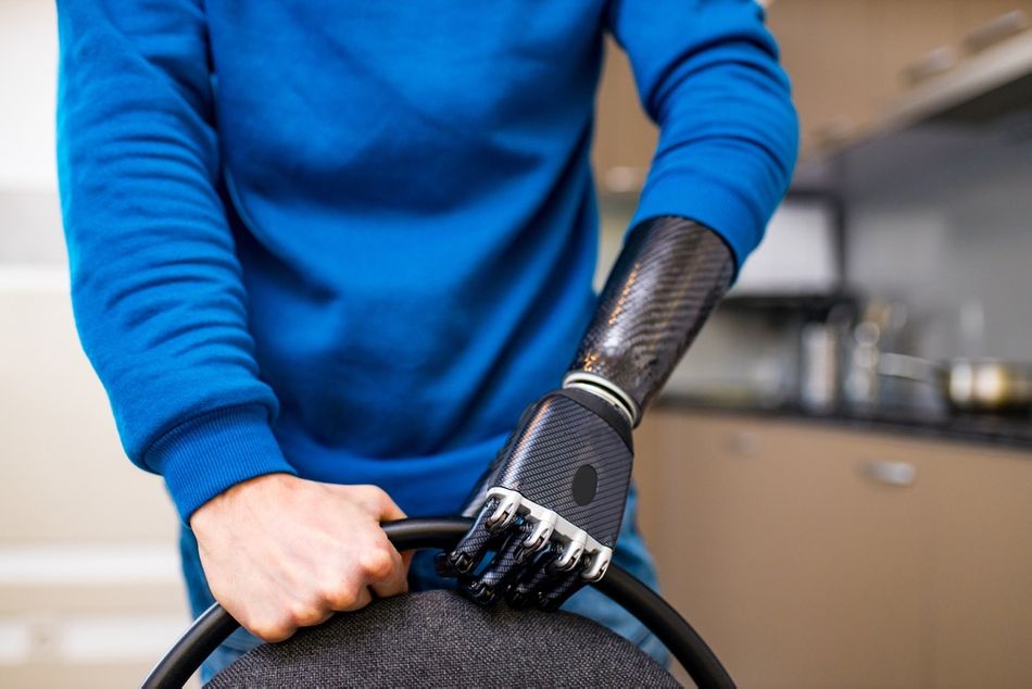 A bionic arm for amputees features flex sensors for accurate movement tracking