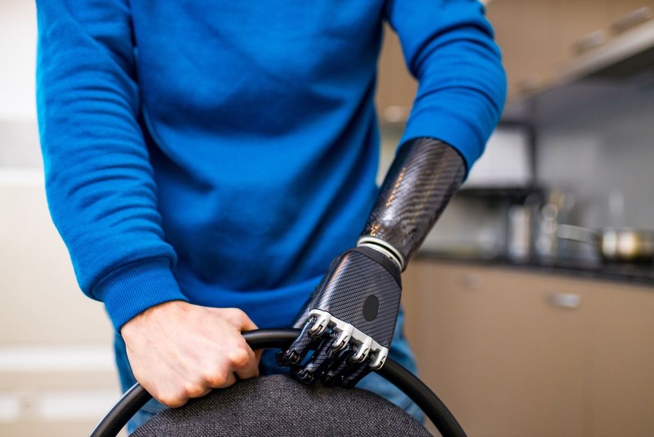 A bionic arm for amputees features flex sensors for accurate movement tracking