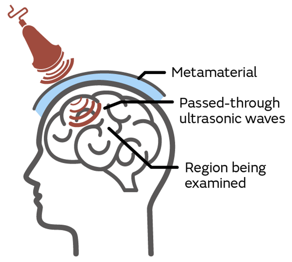 Image of using an ultrasonic scan to examine a brain encased in the cranium