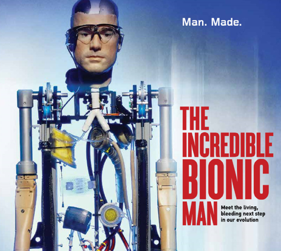 The Bionic Man demonstrates Shadow’s diverse clients; Source: Shadow Robot