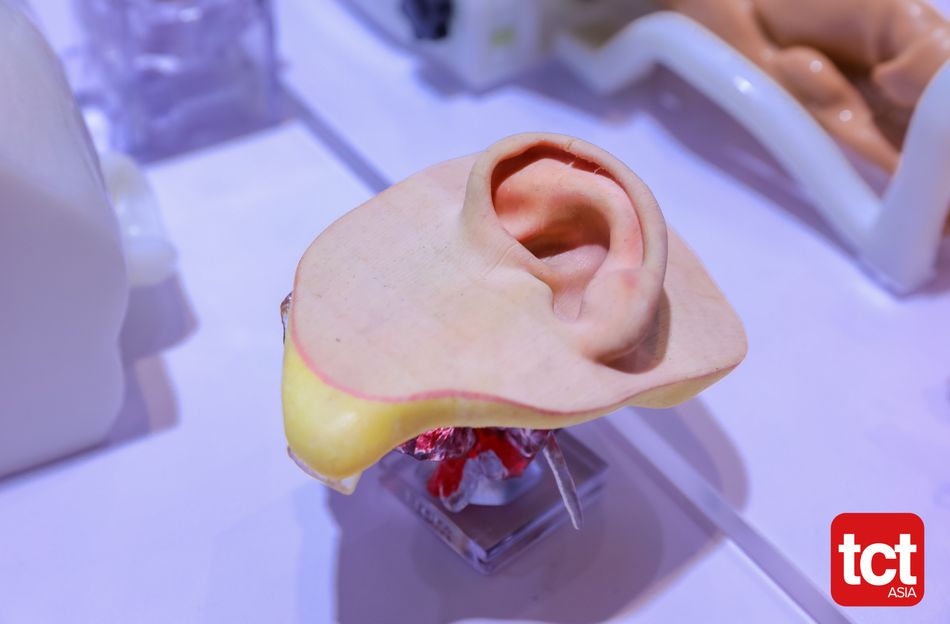 TCT Asia; Source: alltuu