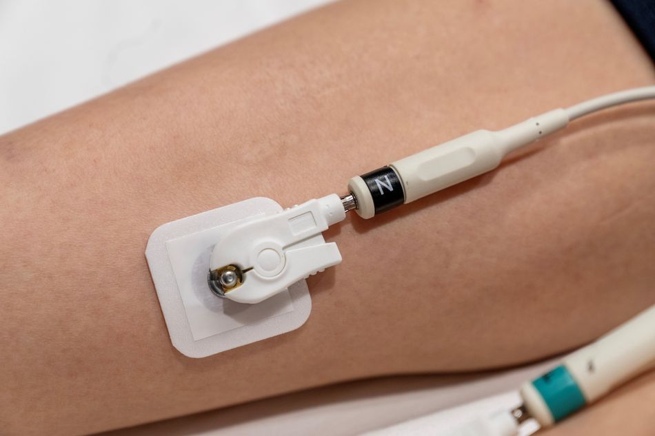 Closeup view of ECG electrodes attached to patient’s arms